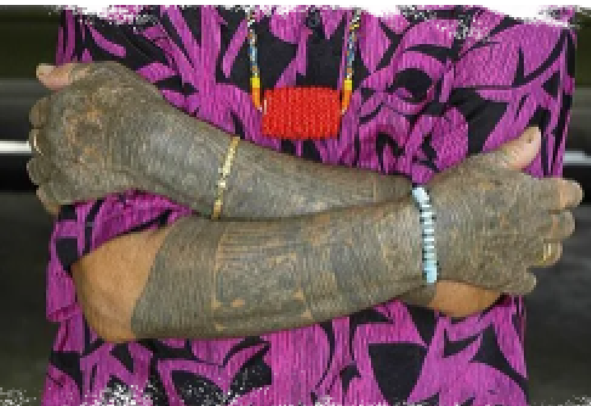 Kayan tribe arm tattoos